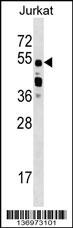 CUGBP2 Antibody