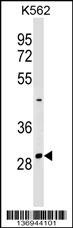 NRIP2 Antibody