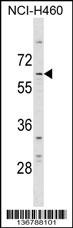 DCP1A Antibody