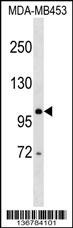 DDX24 Antibody