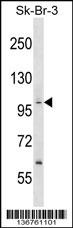 PPP1R13B Antibody