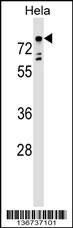 TBX2 Antibody