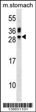 TNNI3 Antibody