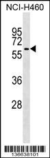 TRIM68 Antibody