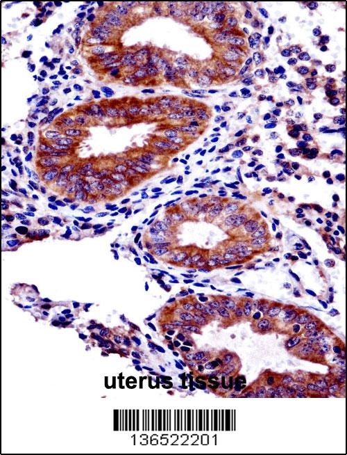 JADE3 Antibody