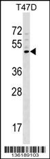 GCNT1 Antibody