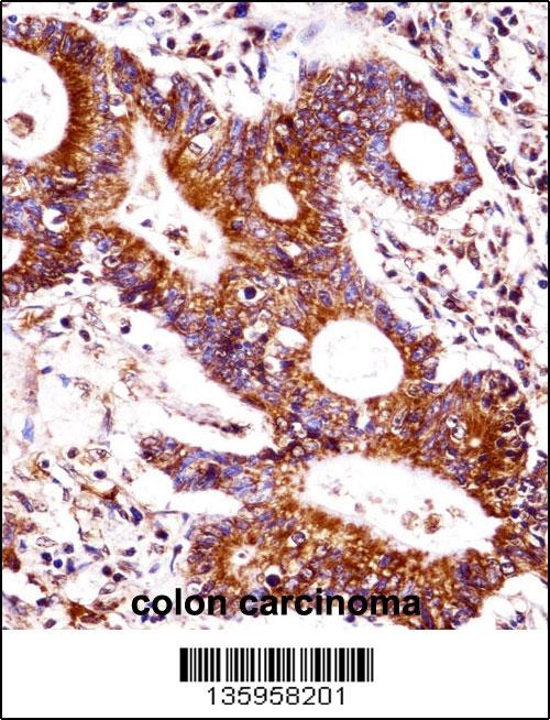 CEACAM7 Antibody