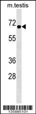 CBX2 Antibody