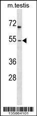 FOXF1 Antibody