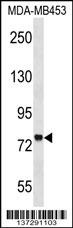 ZNF16 Antibody