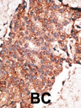 BMP1 Antibody