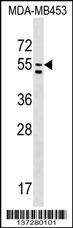 PTDSS1 Antibody