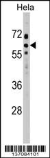 SOCS7 Antibody