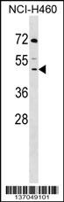 DCPS Antibody