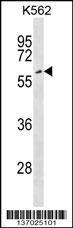 EYA2 Antibody