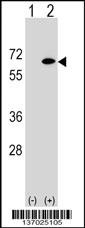 EYA2 Antibody
