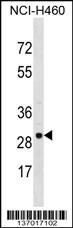 VDAC3 Antibody