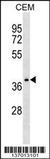 NDRG4 Antibody