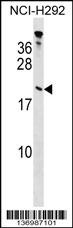 TPPP Antibody