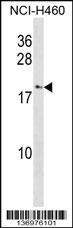 CCL27 Antibody