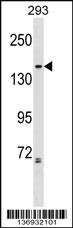 NCAPG2 Antibody