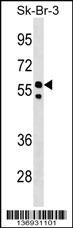 FBXO31 Antibody