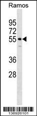 IQCB1 Antibody