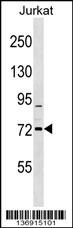 RHOBTB1 Antibody
