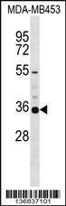 KCNA5 Antibody
