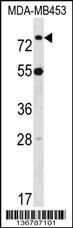 LDB3 Antibody