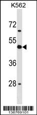 CD1D Antibody