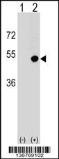 CD1D Antibody