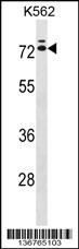 IL23R Antibody