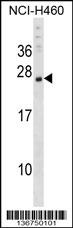 CSRP3 Antibody