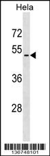 VIPR2 Antibody