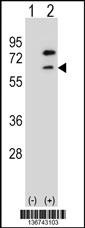 ZBTB7B Antibody