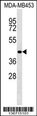 RBM4 Antibody