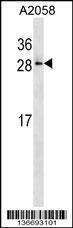RAB28 Antibody