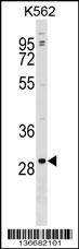 POLR3G Antibody