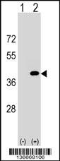 PPP1CC Antibody