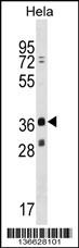 MAGEB16 Antibody