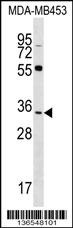 FKBP6 Antibody