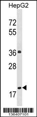 PPM1M Antibody
