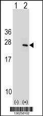 PTP4A1 Antibody