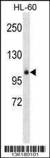 GPLD1 Antibody