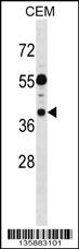 TSSC1 Antibody