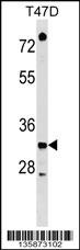 TSFM Antibody