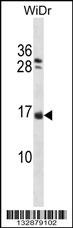 NHLH1 Antibody