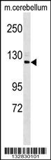 SEMA6D Antibody