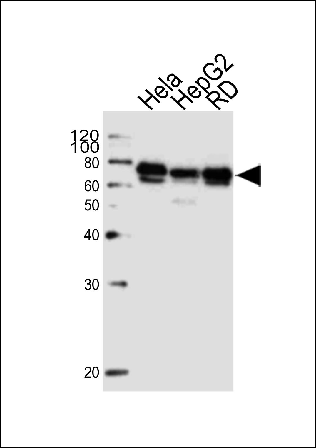 PRKAG3 Antibody